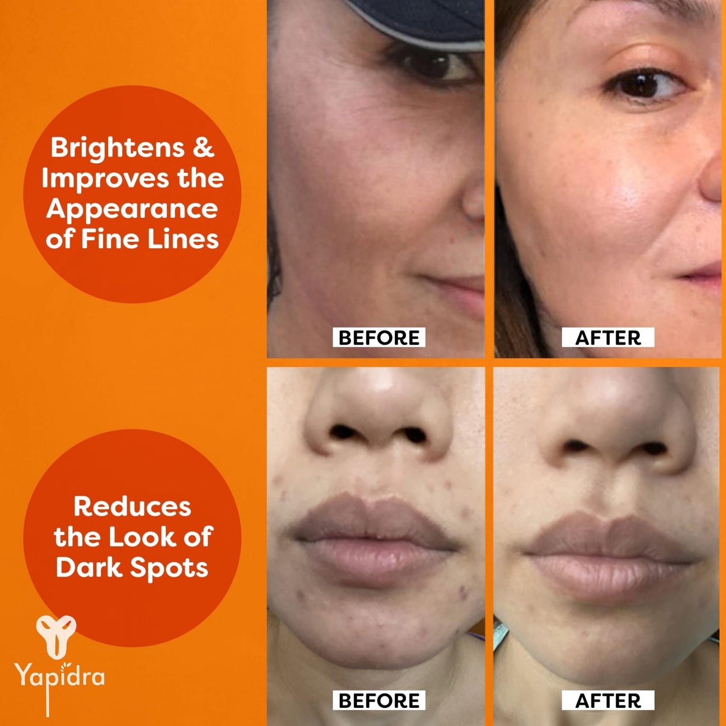 Yapidra Vitamin C Face Serum – Brightens Skin & Fades Dark Spots